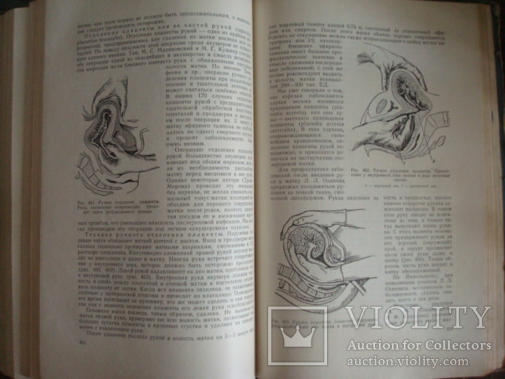 Акушерство,руководство для врачей и студентов,А.И.Петченко 1965г. тир.25тыс., фото №10