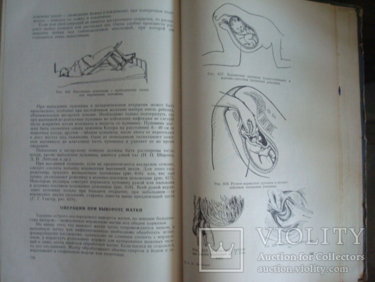 Акушерство,руководство для врачей и студентов,А.И.Петченко 1965г. тир.25тыс., фото №12