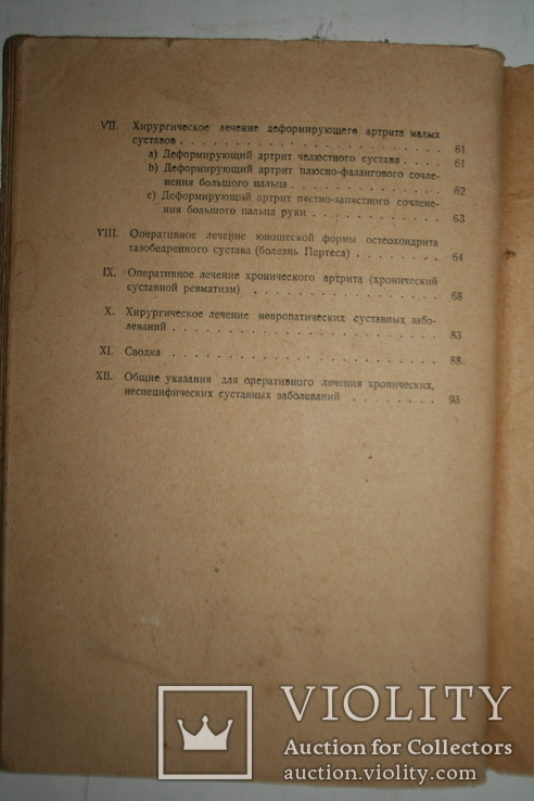 Хирургическое лечение хронических заболеваний суставов. 1929, фото №7