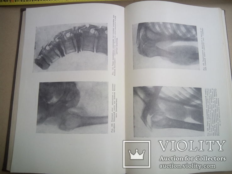 Рентгенодиагностика заболеваний костей и суставов, фото №4