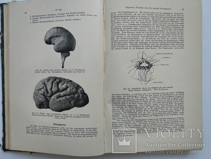 1910 Неврология Немецкий язык Левандовский, фото №11