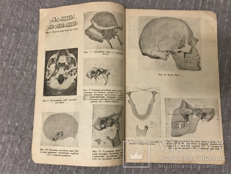 Протезна Стоматологія 1920ті р 415 Малюнків, фото №4