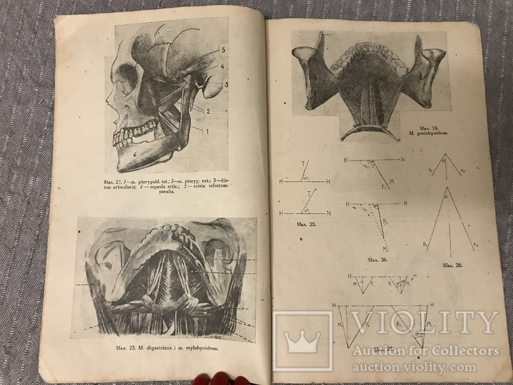 Протезна Стоматологія 1920ті р 415 Малюнків, фото №5