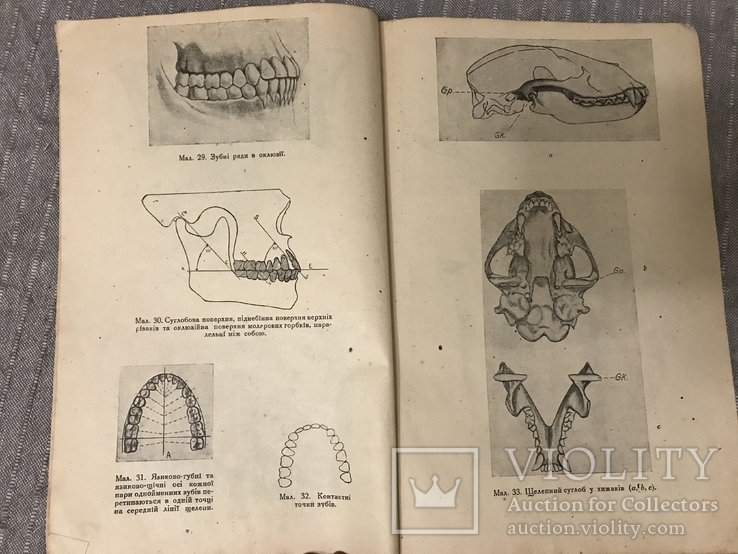 Протезна Стоматологія 1920ті р 415 Малюнків, фото №6