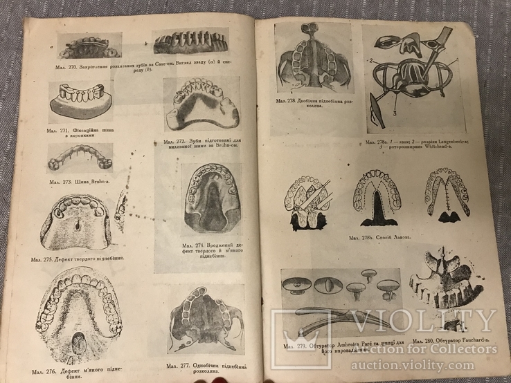 Протезна Стоматологія 1920ті р 415 Малюнків, фото №10