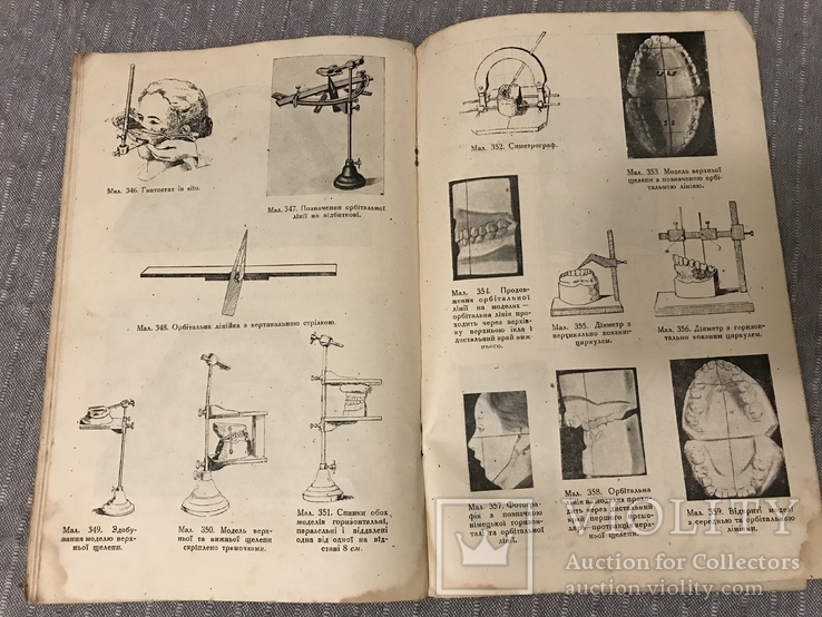 Протезна Стоматологія 1920ті р 415 Малюнків, фото №11