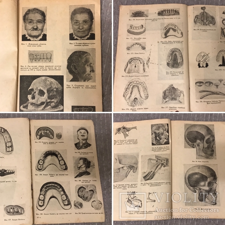 Протезна Стоматологія 1920ті р 415 Малюнків, фото №2