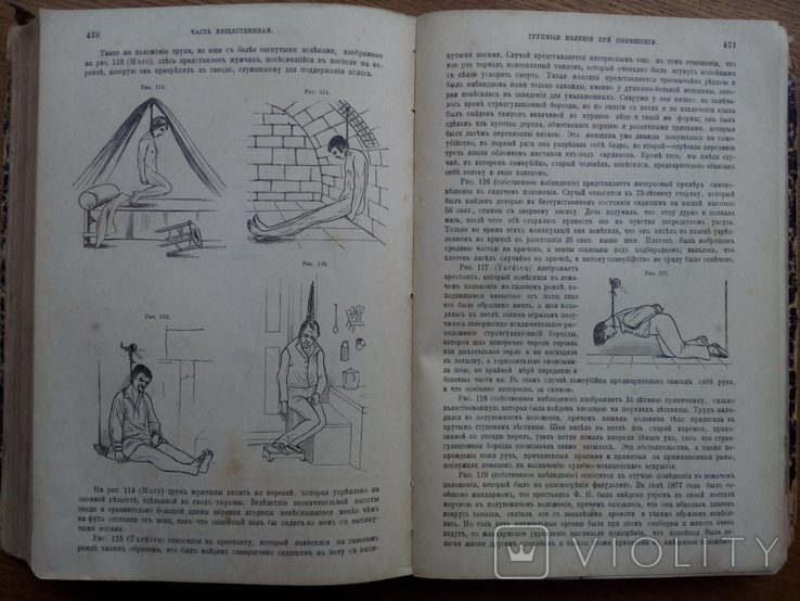 Судебная медицина 1901г. С иллюстрациями не для слабонервных, фото №6