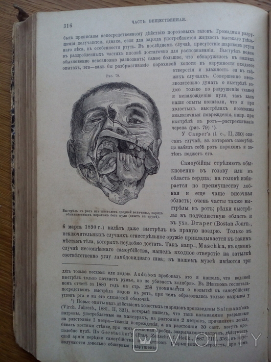 Судебная медицина 1901г. С иллюстрациями не для слабонервных, фото №8