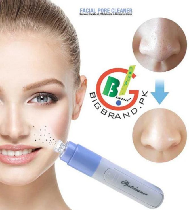 Вакуумный очиститель пор лица Spot Face Cleaner, Pore Cleaner прибор для чистки пор лица, photo number 2