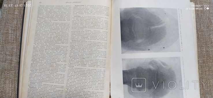 Ветеринарный энциклопедический словарь, 1950-1951 (2тома), фото №6