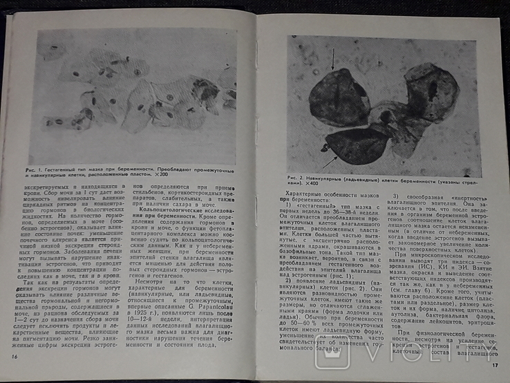 Максимов Г.П. - Функціональна діагностика в акушерстві та гінекології, 1989, фото №5
