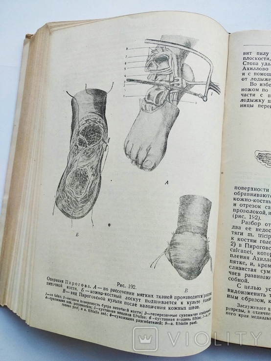 1938 Курс оперативной хирургии В.Шевкуненко 1-й том, фото №12