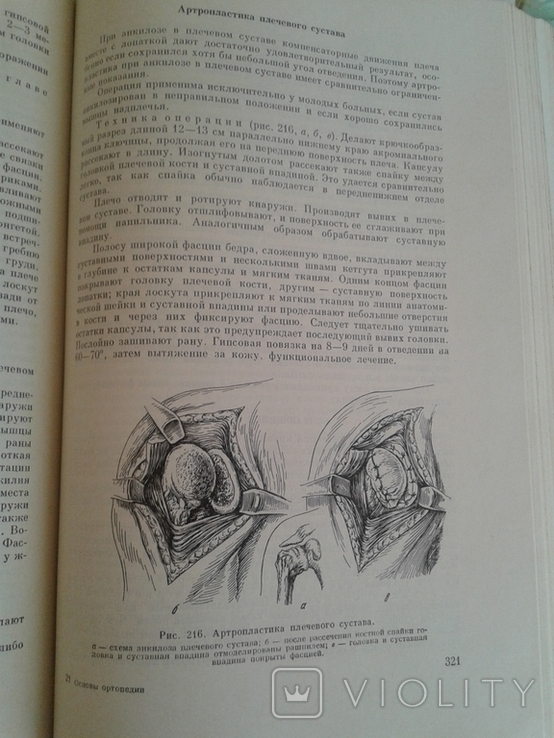 Основы оперативной ортопедии и травматологии., фото №4