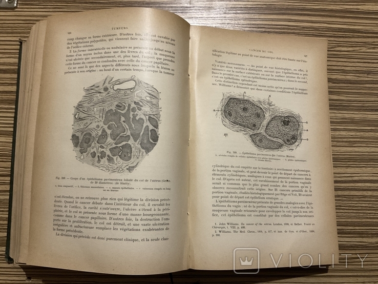 Gyncologie 1904 Paris / Гінекологія, гинекология, фото №10