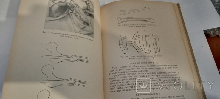 Сборник научных информаций 1947г т. 2 000 Издательство СВА отдел здравоохранения в Герман, фото №8