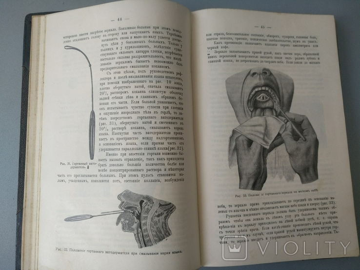 1913 год Медицина отиатрия, фото №2