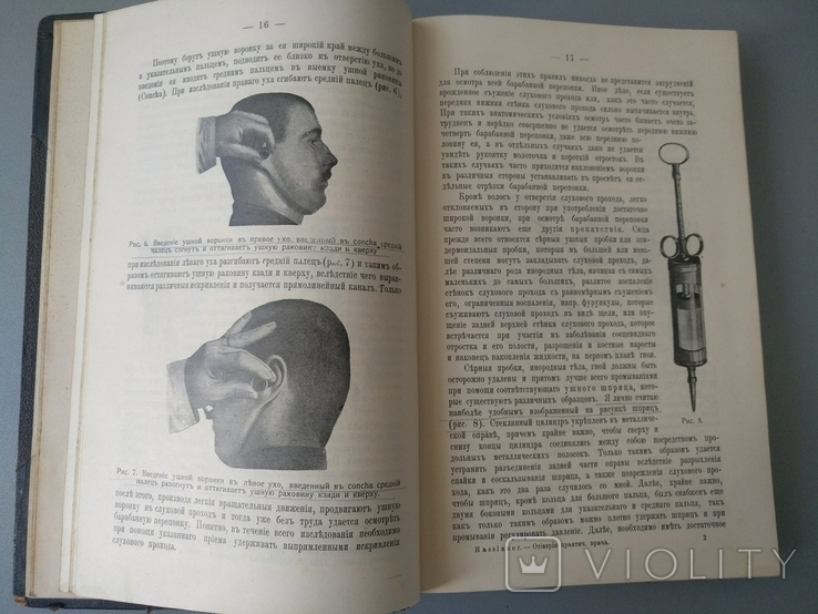 1913 год Медицина отиатрия, фото №9
