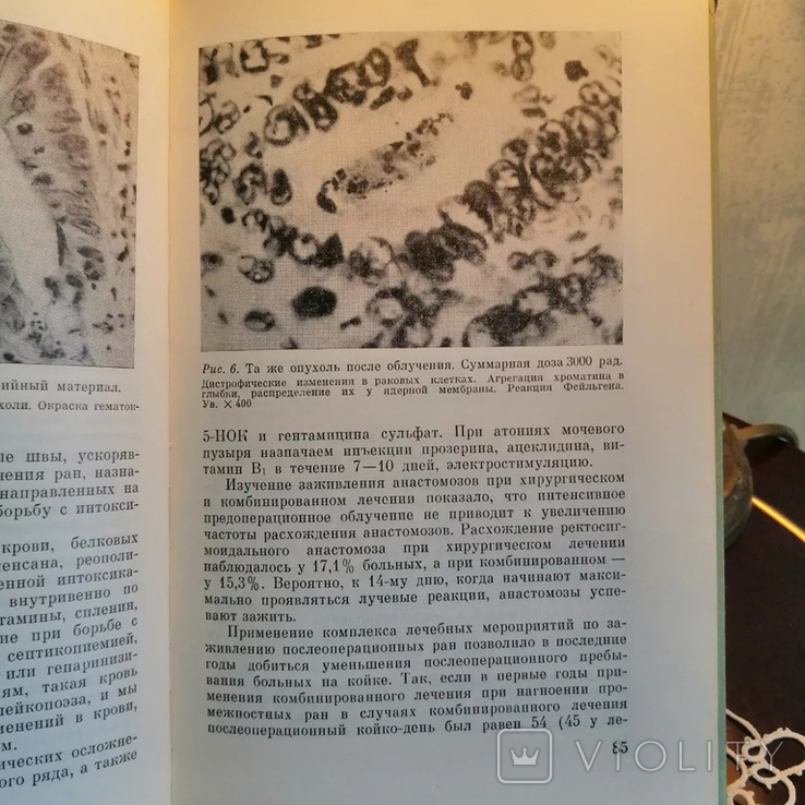 Книги про медицину. Пухлина і не тільки, фото №9