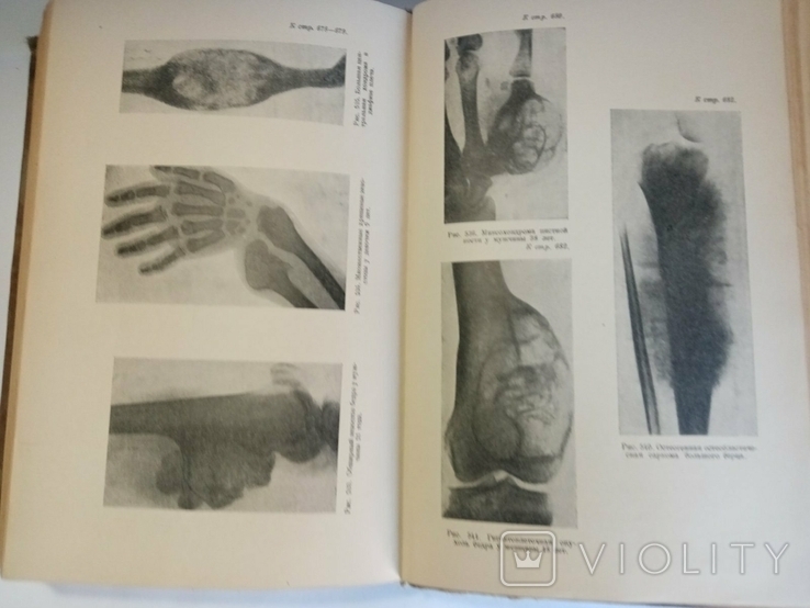 Textbook of Private Surgery, S. Girgolab, 1940, photo number 4