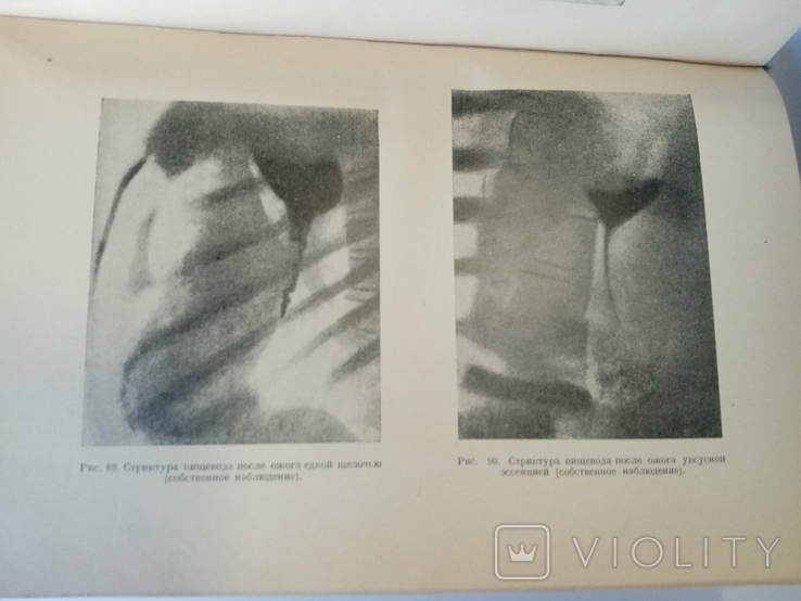 Textbook of Private Surgery, S. Girgolab, 1940, photo number 6