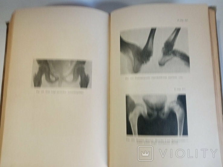 Textbook of Private Surgery, S. Girgolab, 1940, photo number 7