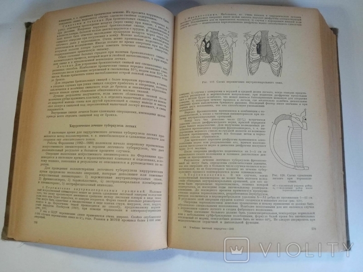 Textbook of Private Surgery, S. Girgolab, 1940, photo number 9