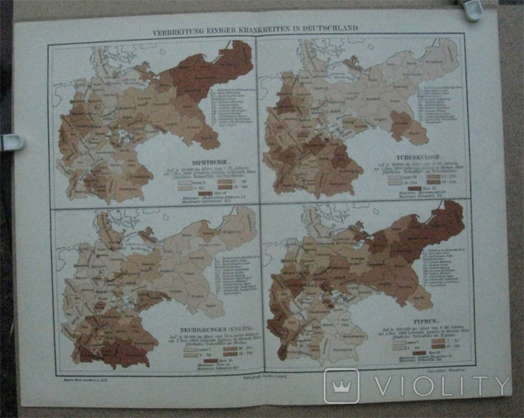 Болезни в Германии в начале 20 века. 244х 305 мм,1910-е гг, нем. язык, фото №3