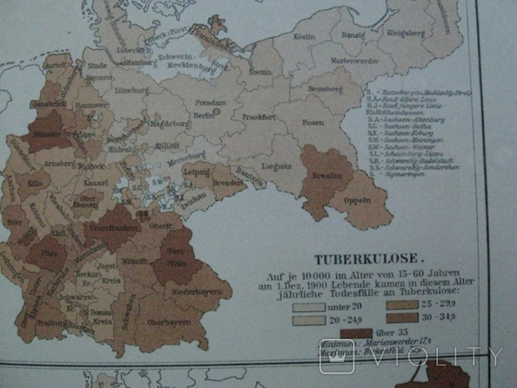 Болезни в Германии в начале 20 века. 244х 305 мм,1910-е гг, нем. язык, фото №8