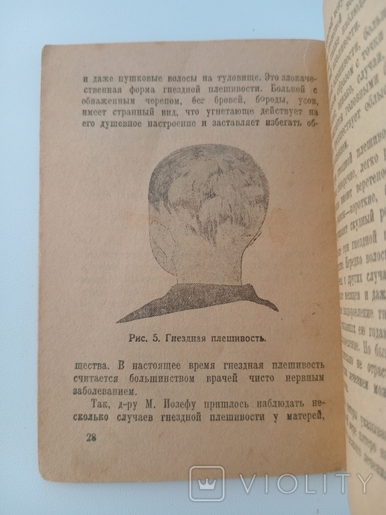 Книга Болезни волос 1930, фото №7