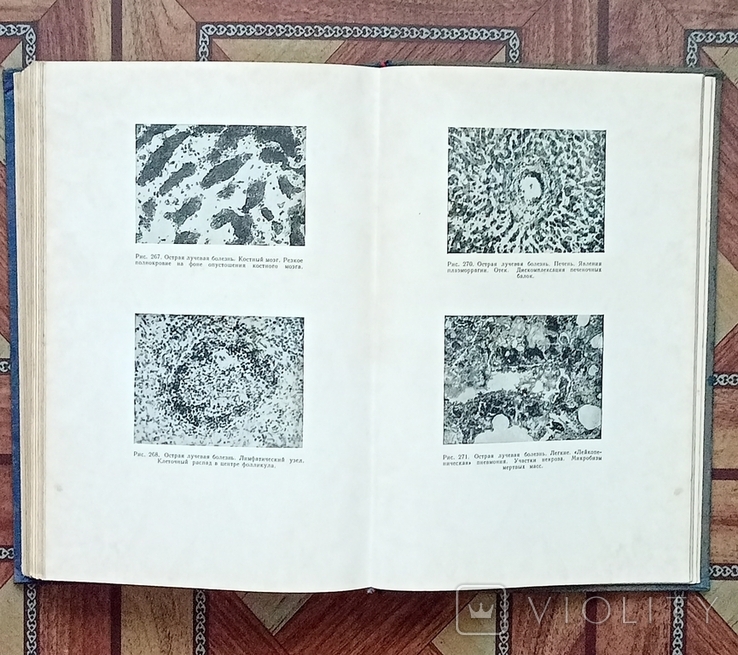 Патологическая анатомия издание 1954 год, фото №3