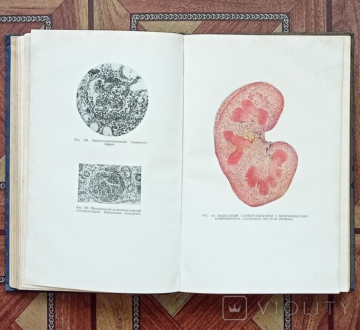 Патологическая анатомия издание 1954 год, фото №4