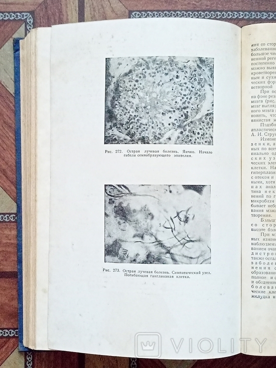 Патологическая анатомия издание 1954 год, фото №7