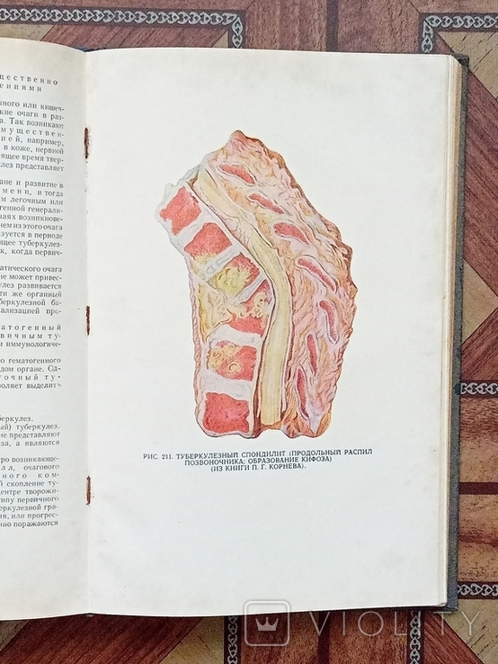 Патологическая анатомия издание 1954 год, фото №8