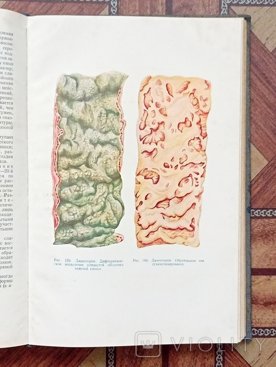 Патологическая анатомия издание 1954 год, фото №9