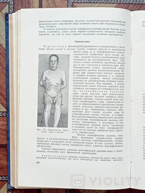 Патологическая анатомия издание 1954 год, фото №11