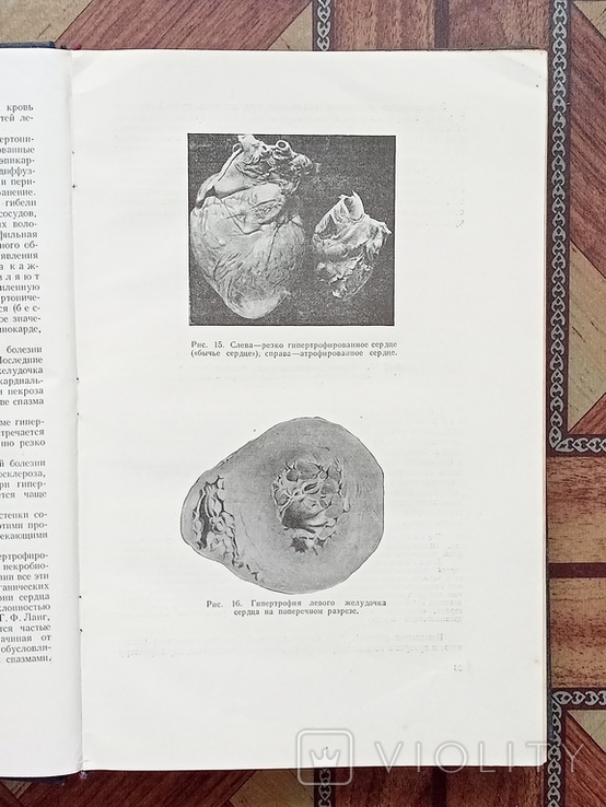 Патологическая анатомия издание 1954 год, фото №12