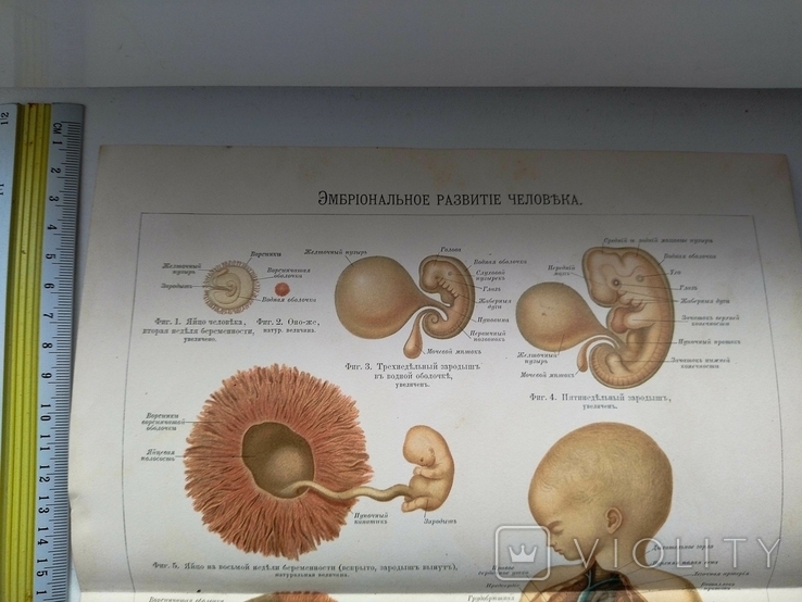 К.9.23.Дореволюционная таблица Эмбриональное развитие человека Анатомия Медицина, фото №8
