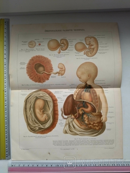 К.9.23.Дореволюционная таблица Эмбриональное развитие человека Анатомия Медицина, фото №2
