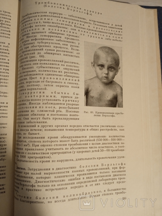Учебник детских болезней. "Медгиз". 1963., фото №3