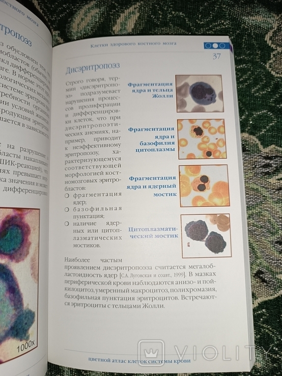 Цветной атлас клеток системы крови В.М. Погорелов 2011г175с, фото №8
