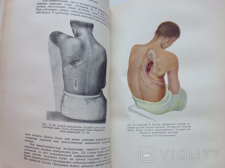 Опыт советской медицины в ВОВ 1941-1945. Том 10, фото №8
