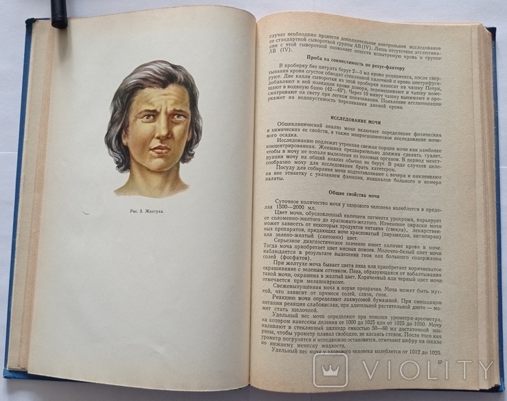 Н. М. Мусуляк, І. Н. Рибкін «Внутрішні хвороби (з доглядом за хворими)». 1970. 304 с. : іл., фото №2