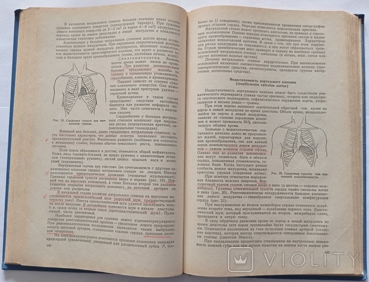 Н. М. Мусуляк, І. Н. Рибкін «Внутрішні хвороби (з доглядом за хворими)». 1970. 304 с. : іл., фото №10