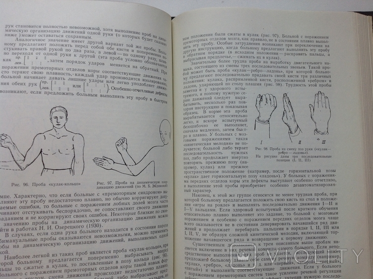 Лурия. Высшие корковые функции человека и их нарушения , 1962, фото №13