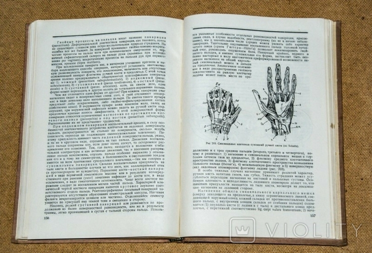 Проф. В. Мыш Очерки хирургической диагностики 1938, фото №10