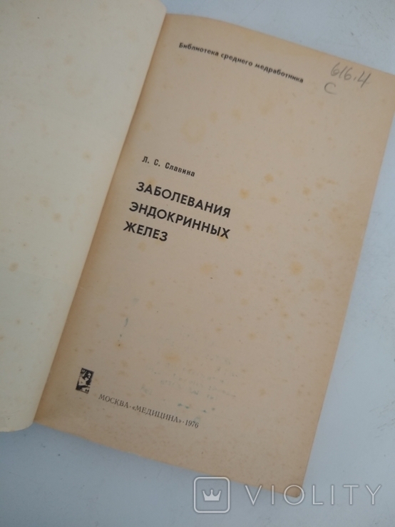 Заболевание эндокринных желез, фото №5