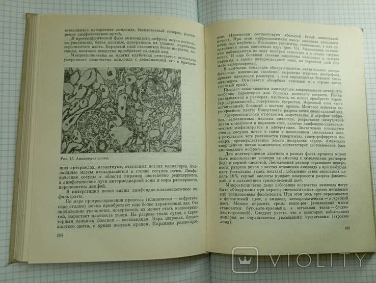 1974. Практич нефрология. Иллюстраций-37, фото №9