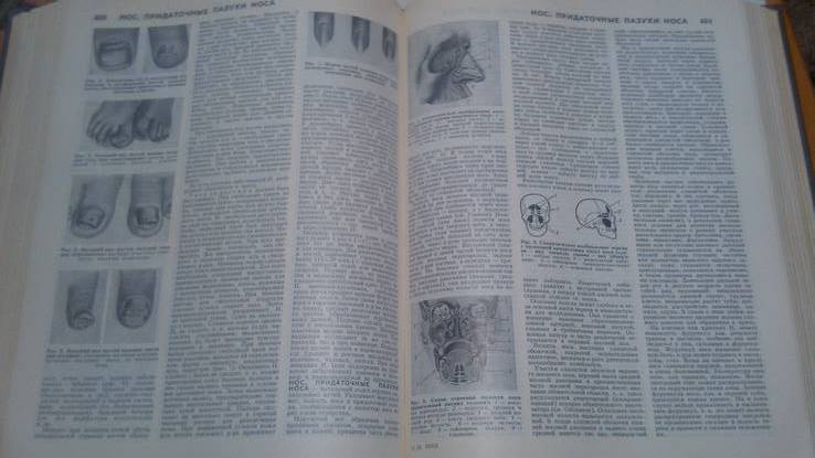 Популярная медицинская энциклопедия, фото №11