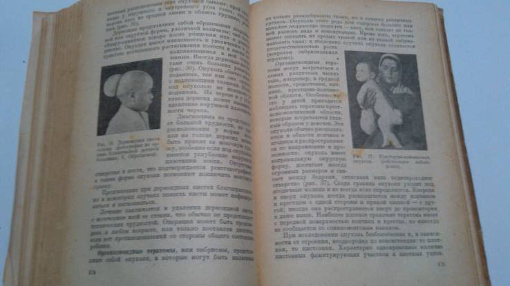 Хирургия детского возраста медгиз 49 год, фото №6